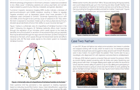 ACUTE REGRESSION IN YOUNG ADULTS WITH DOWN SYNDROME